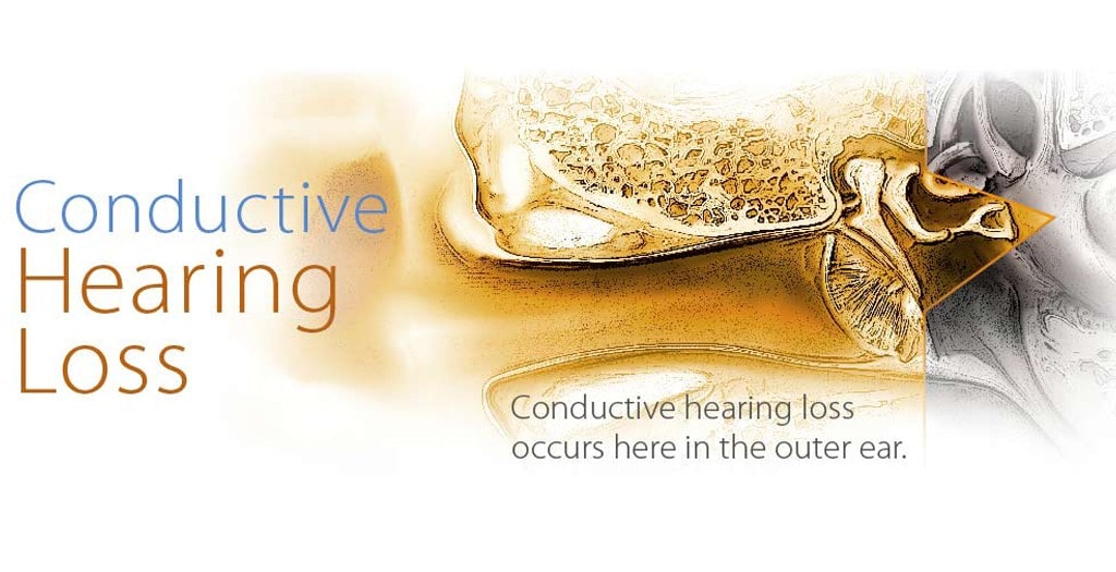 Treatment | Hearing Loss Treatment - Adro Hearing Aid