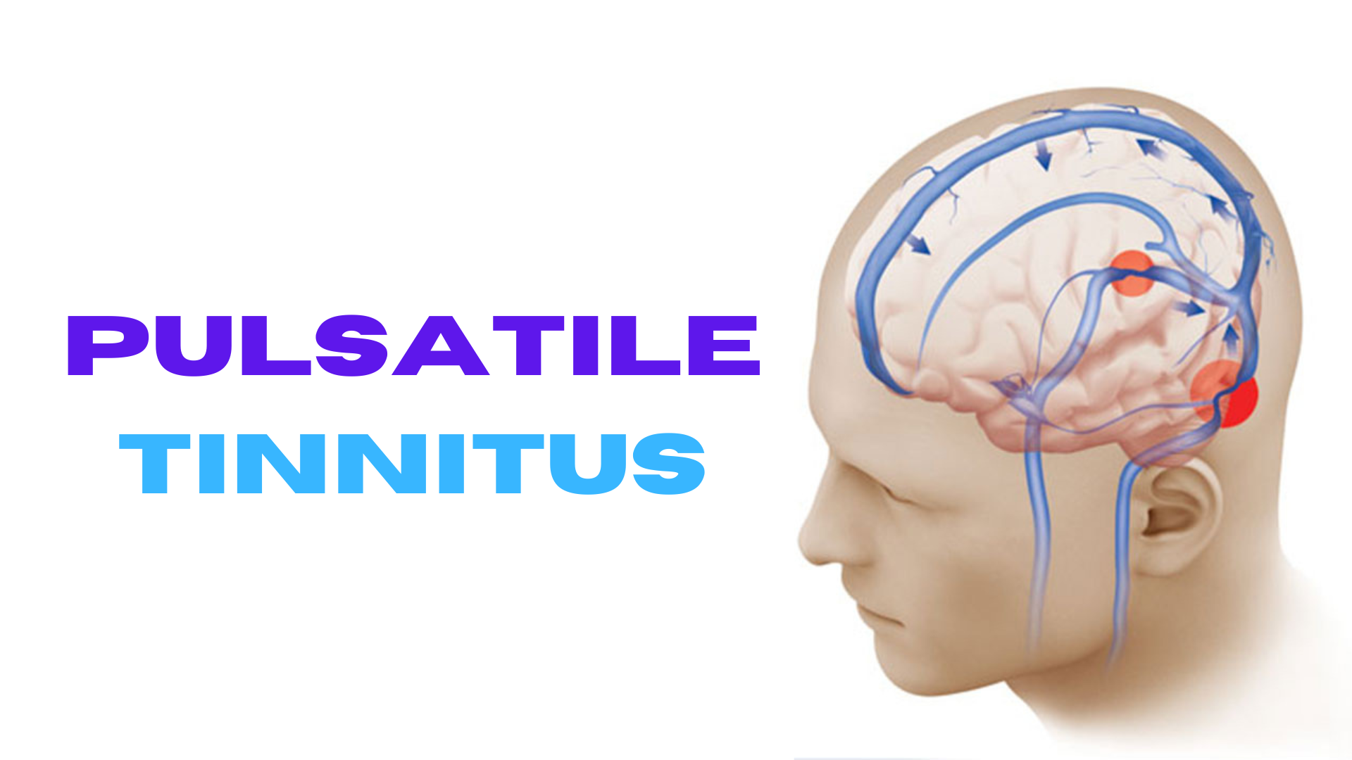 How to Stop Tinnitus in 30 SECONDS - YouTube