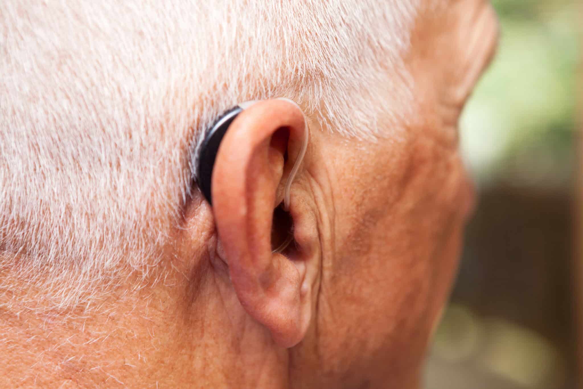 The Benefits of Directional Microphones in Hearing Aids