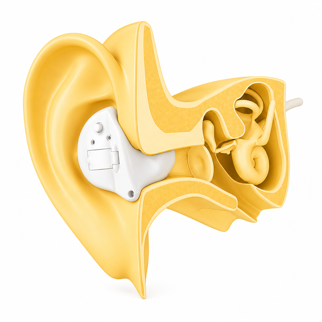 1 Why ITE Hearing aid